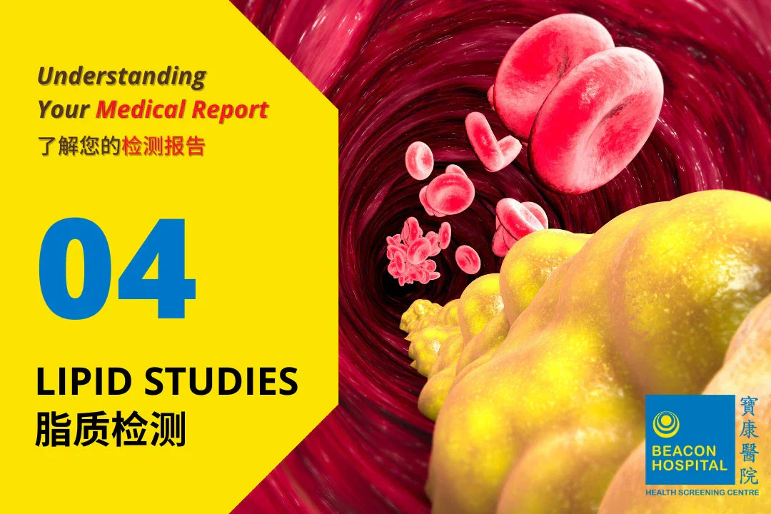 Lipid Studies