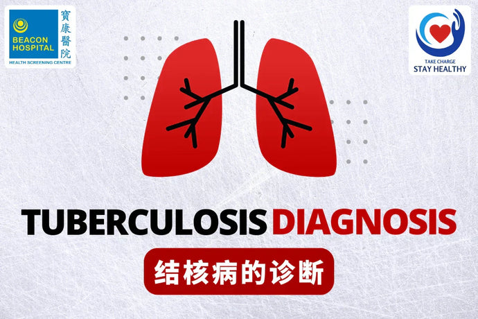 Diagnosis of Tuberculosis