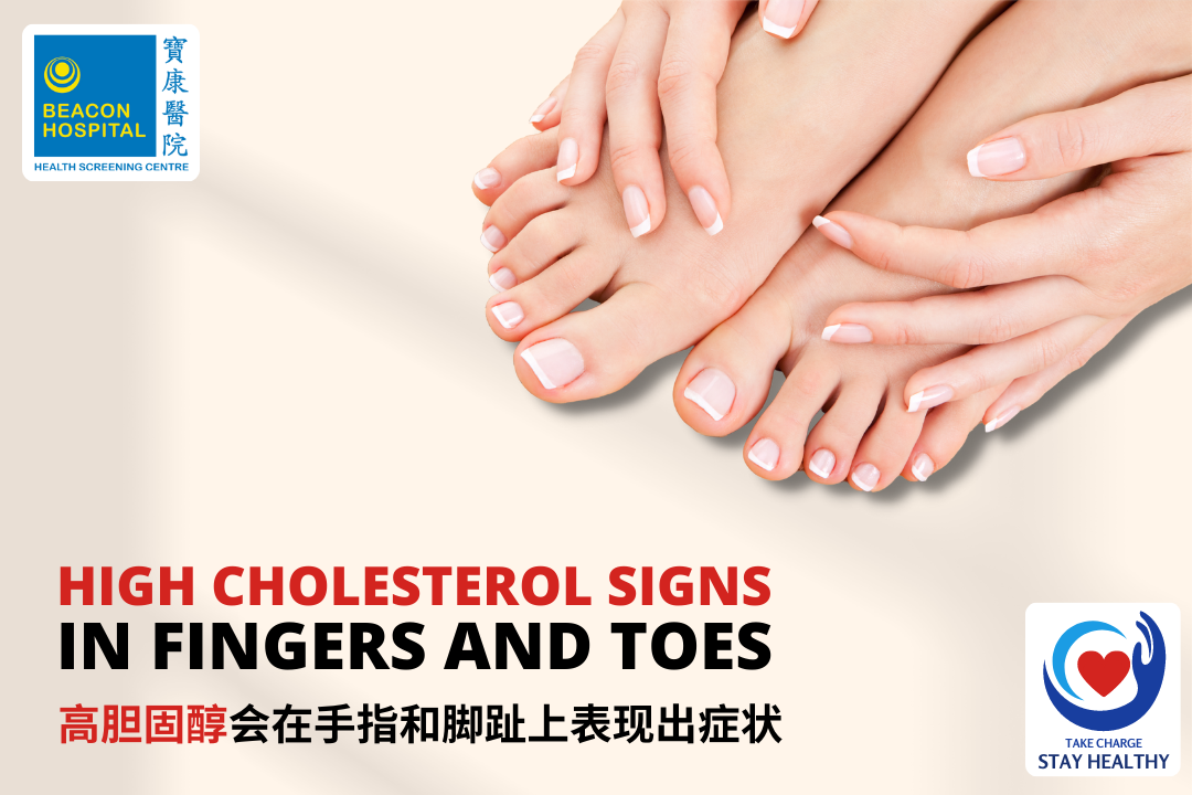 High Cholesterol Signs In Fingers And Toes – Beacon Health Screening Centre