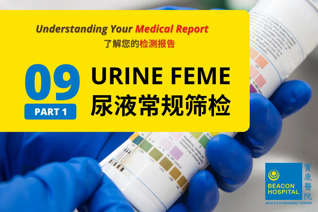 Urine FEME