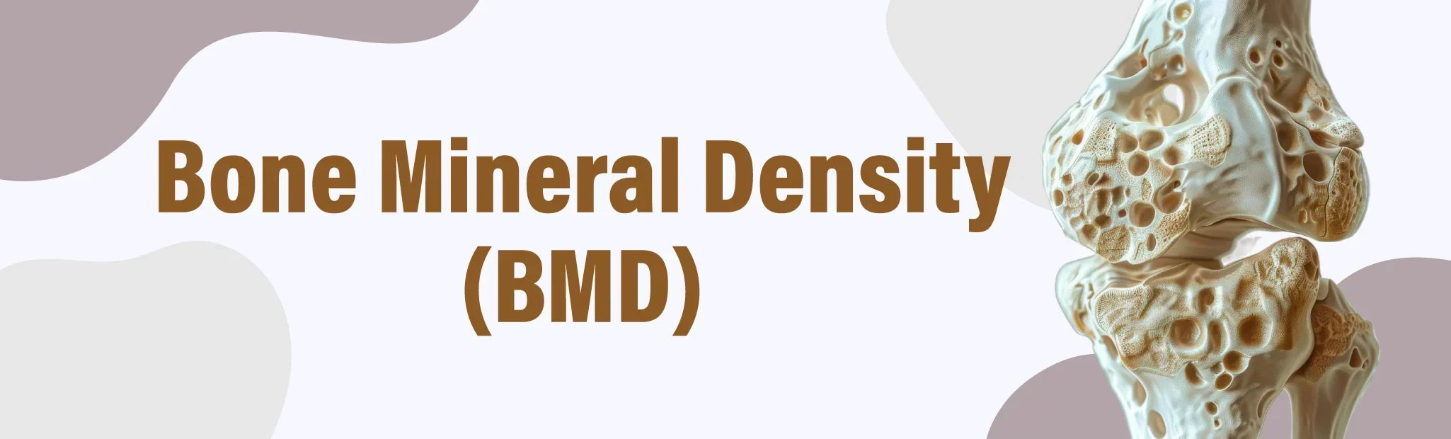 Bone Density Scan
