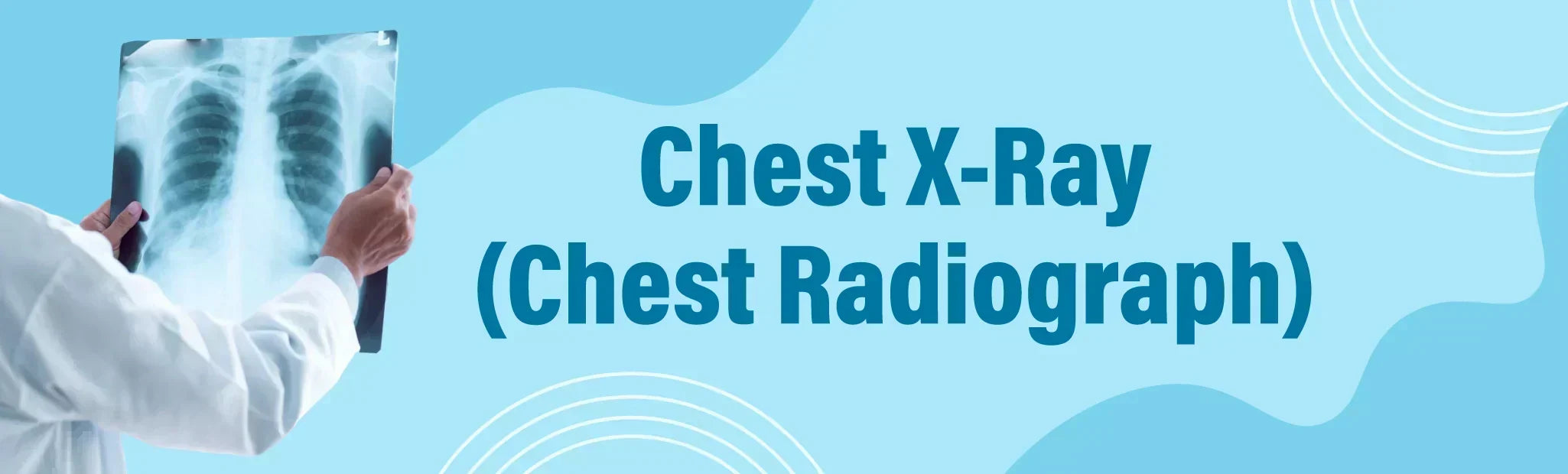 Chest X-Ray