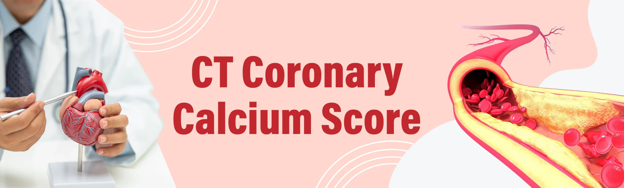 CT Coronary Calcium Score