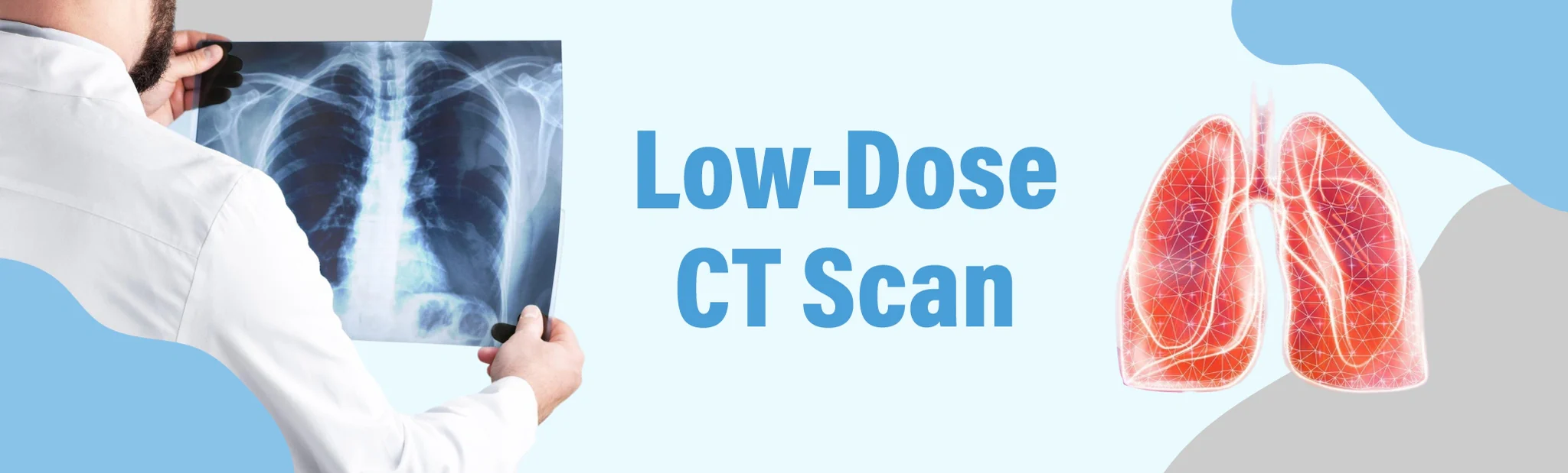 Low-Dose CT Scan