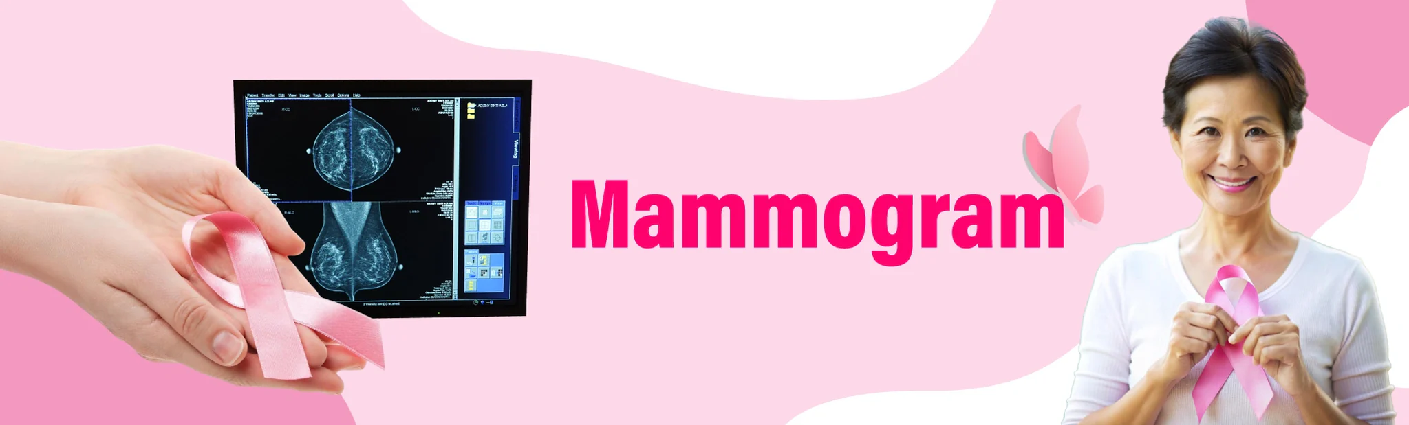 Mammogram