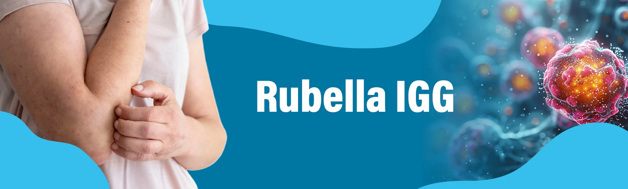 Rubella IGG