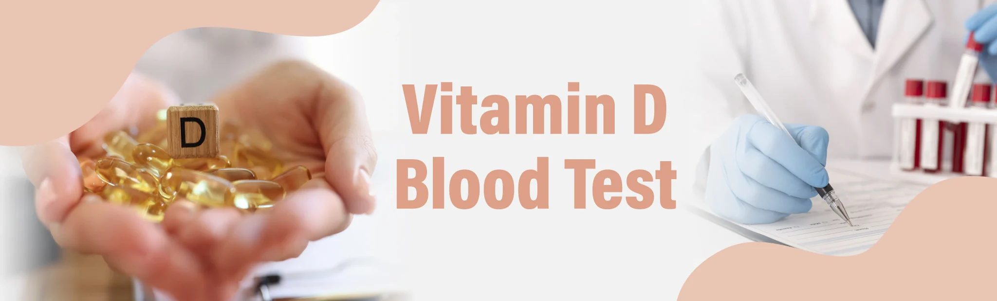 Vitamin D Blood Test
