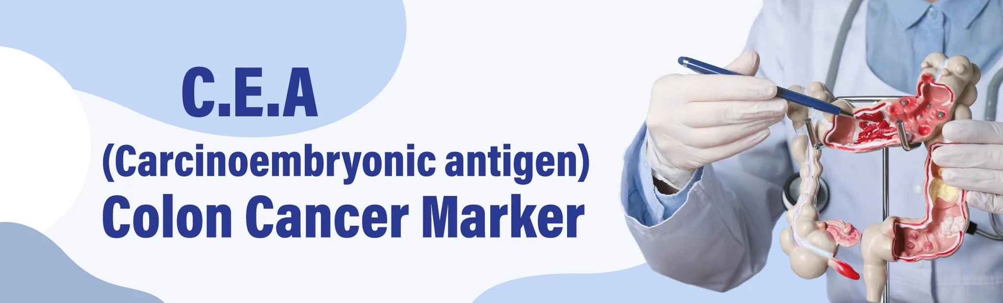 C.E.A - Colon Cancer Marker