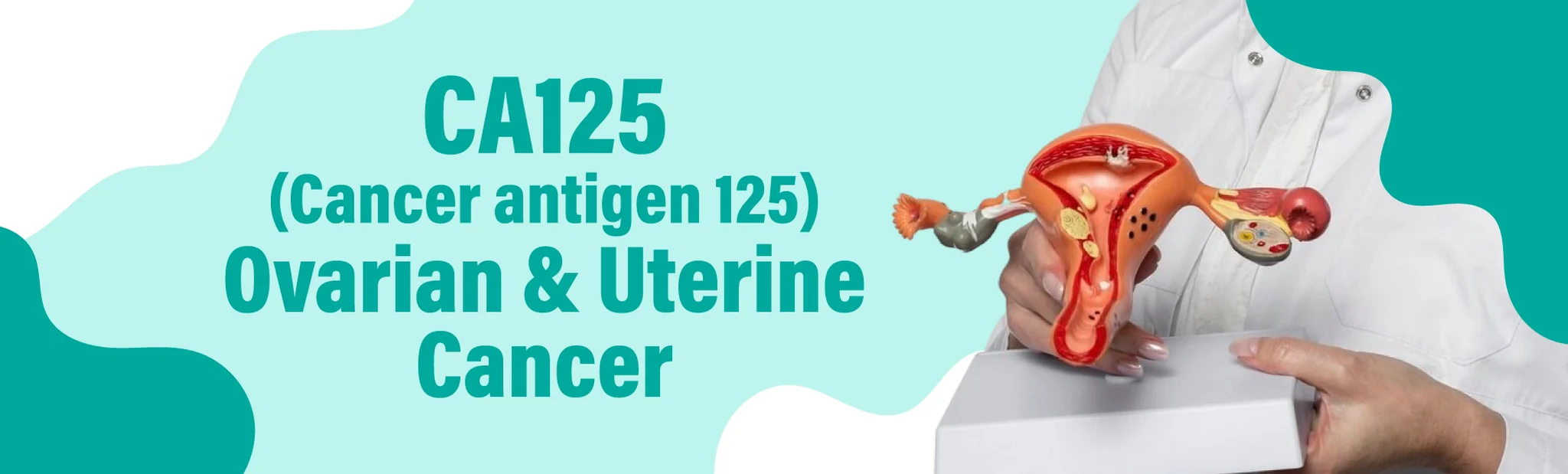 CA 125 - Ovarian & Uterine Cancer Marker