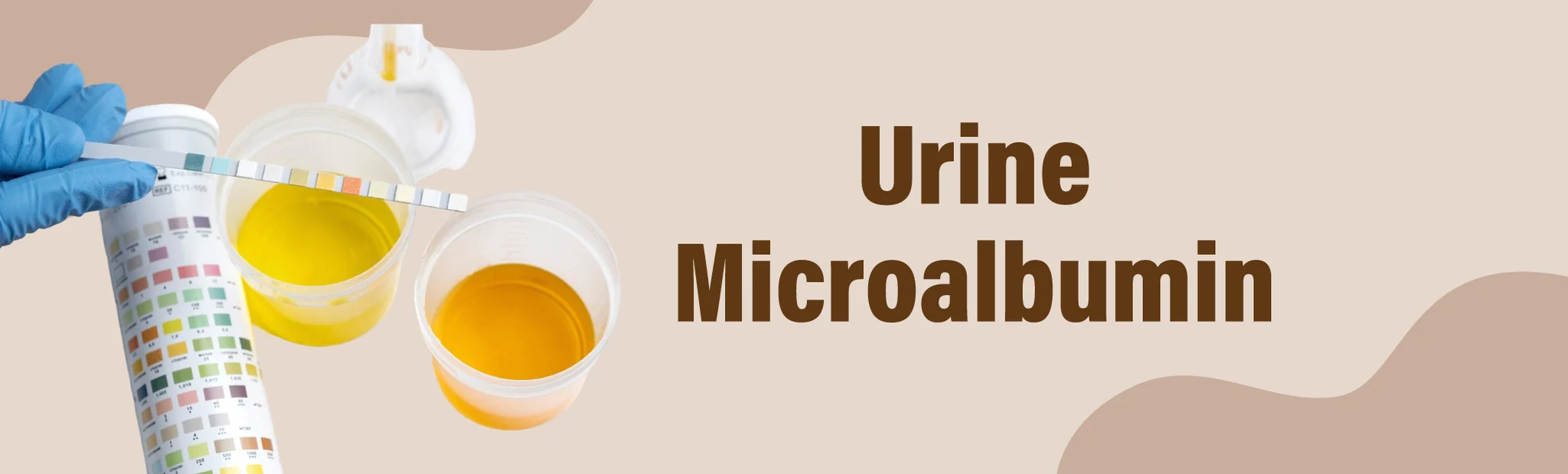 Urine Microalbumin