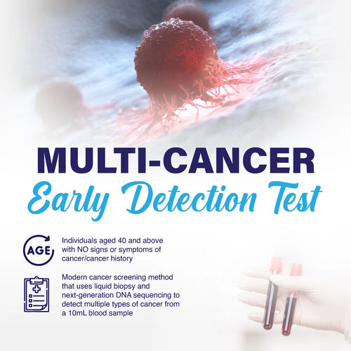 Multi-Cancer Early Detection Test