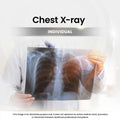 Chest X-ray