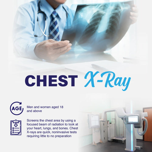 Chest X-Ray