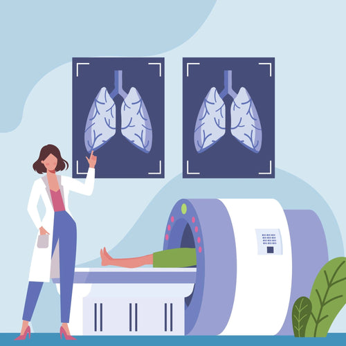 Low-Dose CT (LDCT)