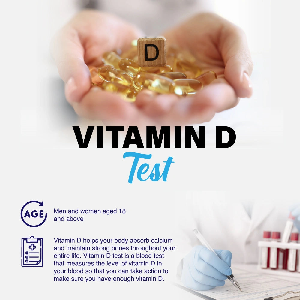 Vitamin D Test