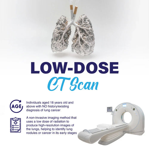 LDCT Scan
