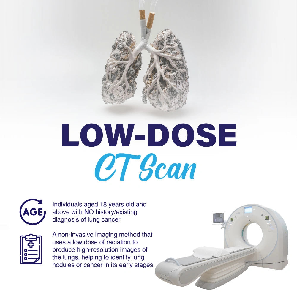 LDCT Scan