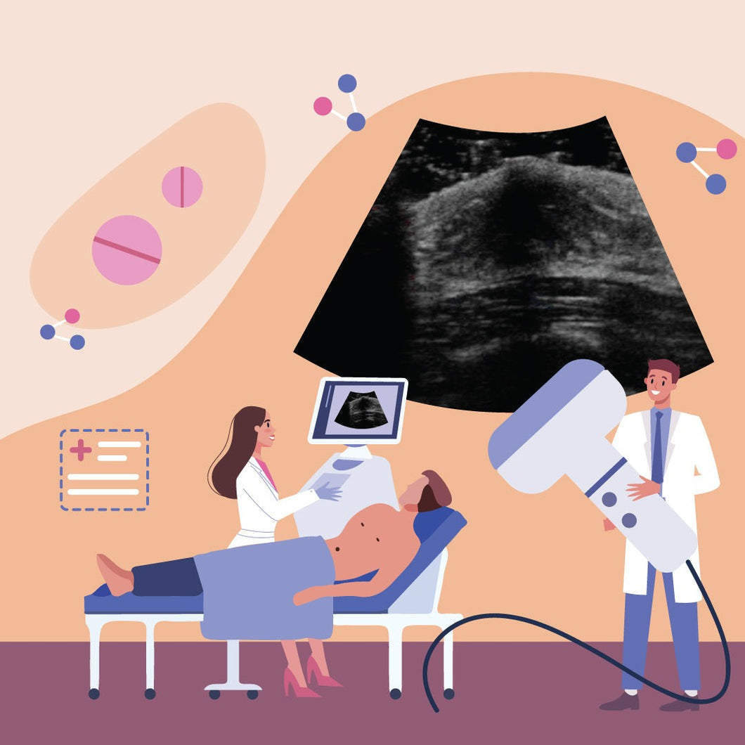 Ultrasound Abdomen & Pelvis